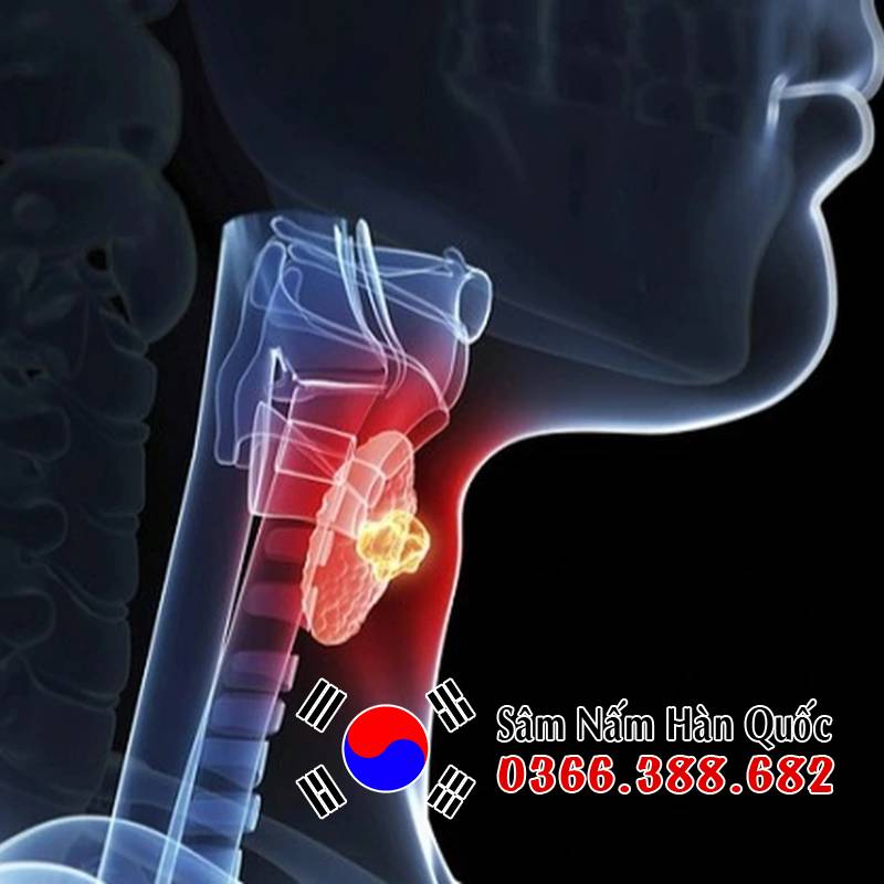 Người bị tuyến giáp có uống được sâm không?